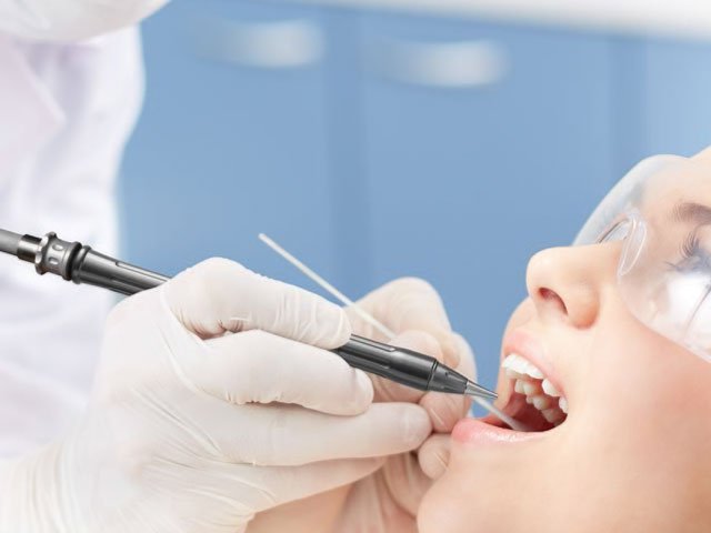 Dental Implants Versus Dental Bridges